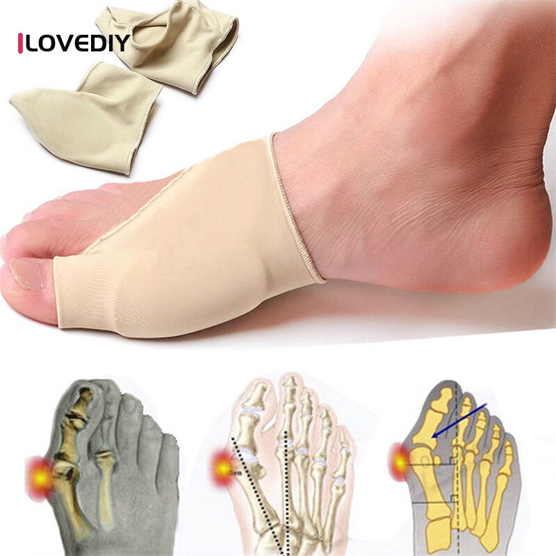 1Pair Bunion Corrector Sleeve Bunion Relief Orthopedic Bunion Splint Pads Toe Straightener Cushions